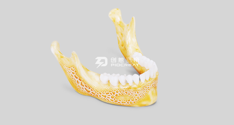 乐鱼-齿科3D打印机在齿科领域的应用